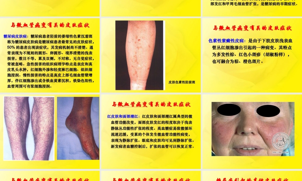 糖尿病与皮肤病.ppt