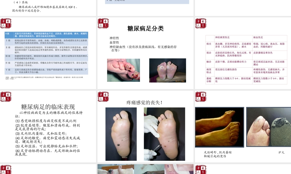 糖尿病足中西医结合诊疗.ppt