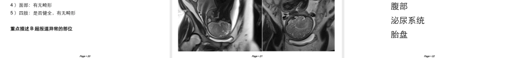胎儿磁共振成像.ppt
