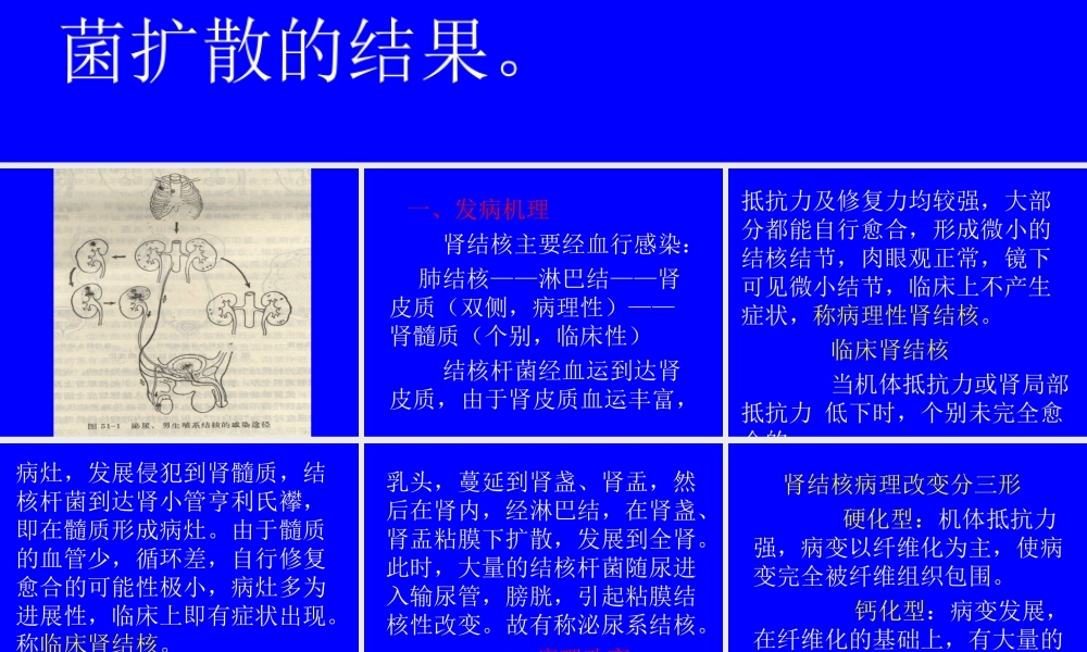泌尿系及男性生殖系结核.ppt