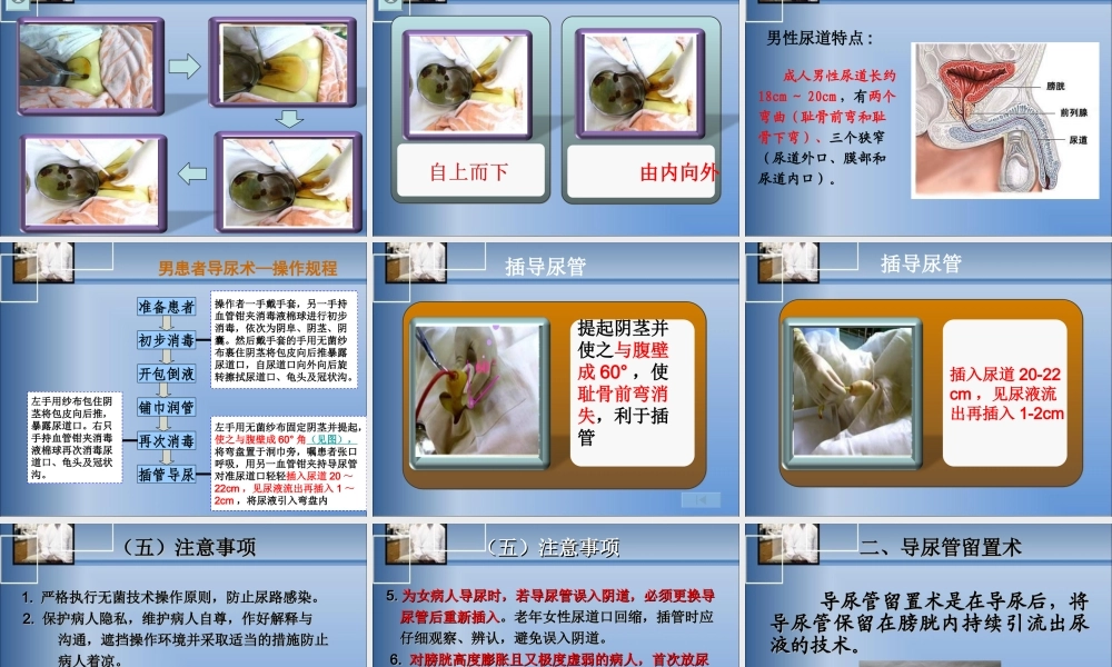 模块十一导尿术资料.ppt