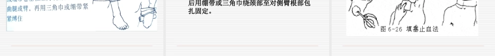 止血包扎固定搬运.ppt