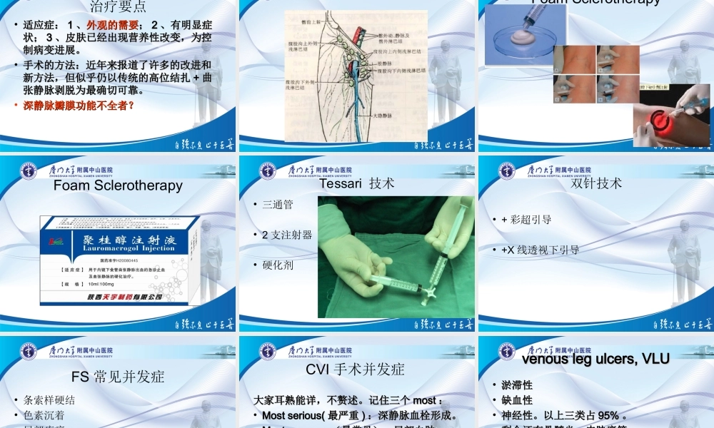 泡沫硬化剂与静脉曲张.ppt