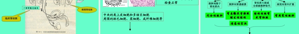 泌尿、男生殖系结核.ppt