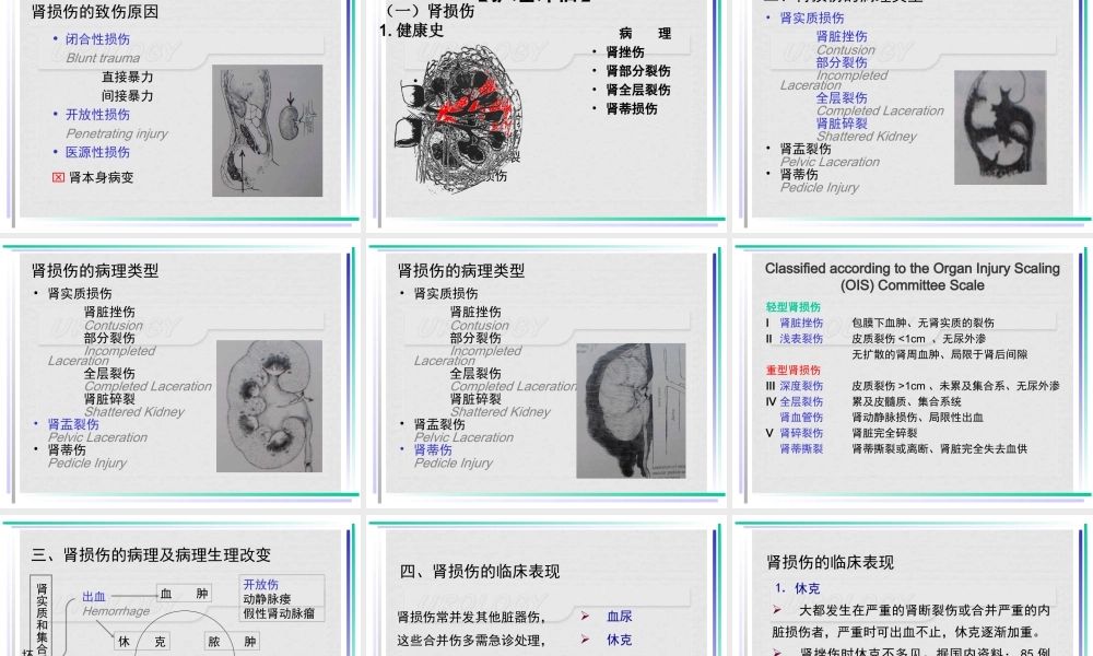 泌尿损伤5.ppt