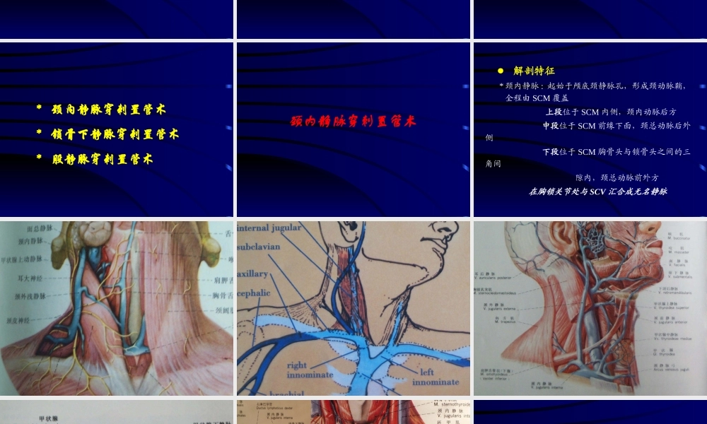 深静脉穿刺术1.ppt