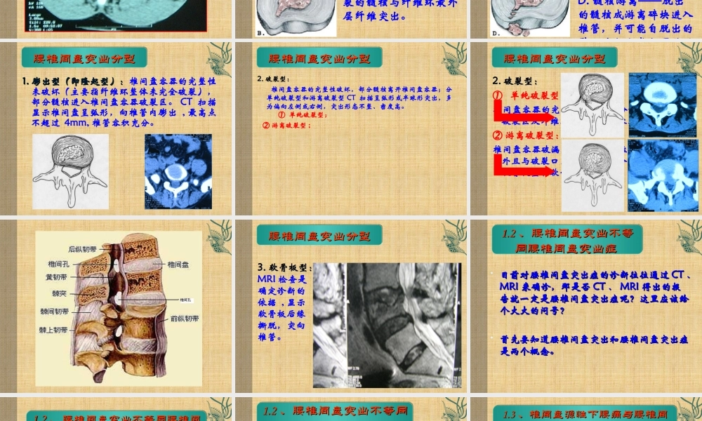 查和萍教授-腰椎间盘突出症.ppt