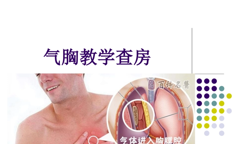 气胸教学查房(1)(1)(2)(1).ppt