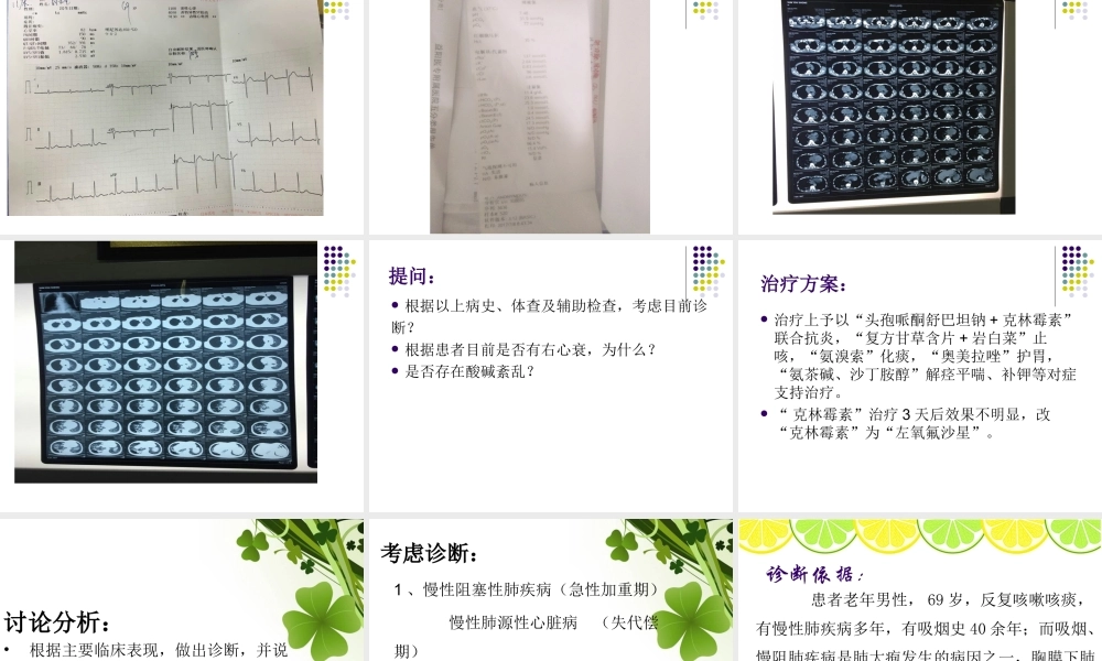 气胸教学查房(1)(1)(2)(1).ppt