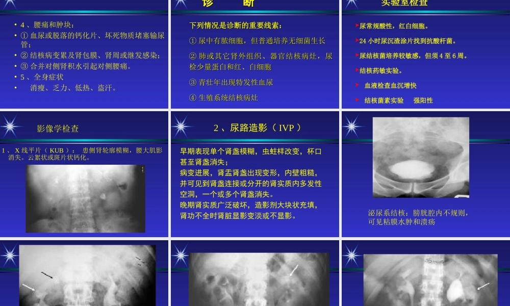 泌尿生殖系统结核资料.ppt