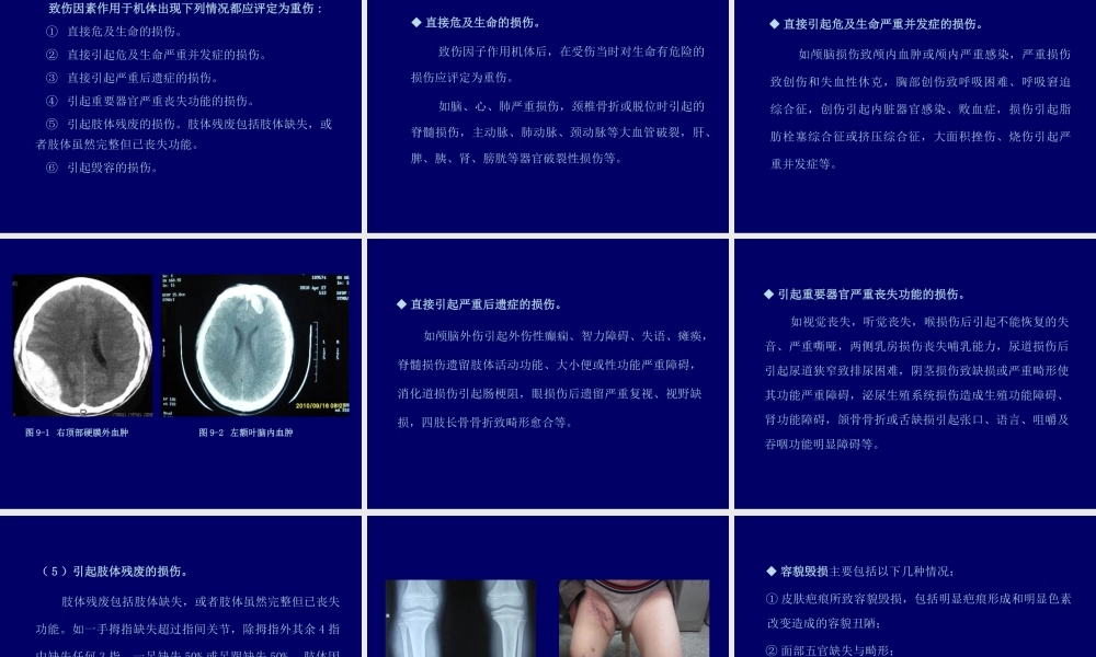 活体损伤鉴定.ppt