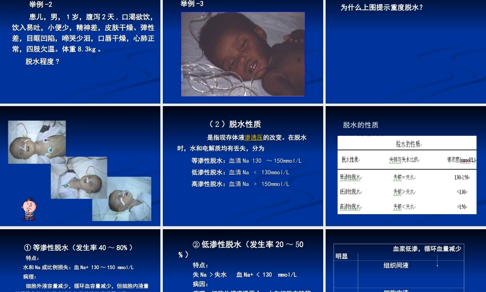 液体疗法2011---上.ppt