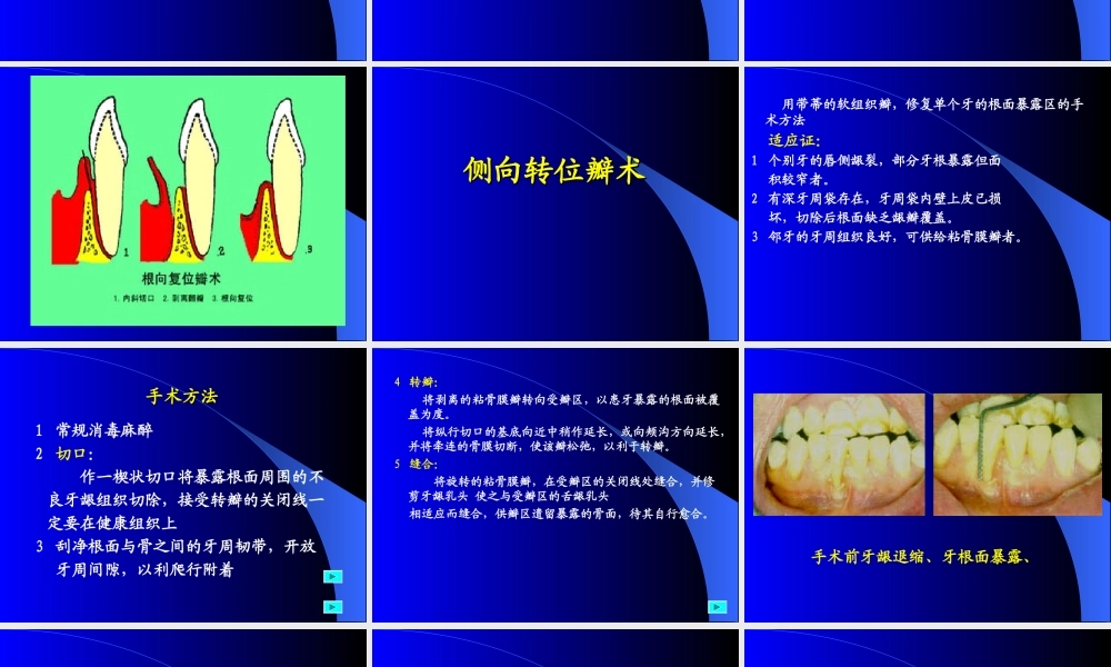 牙周手术1.ppt