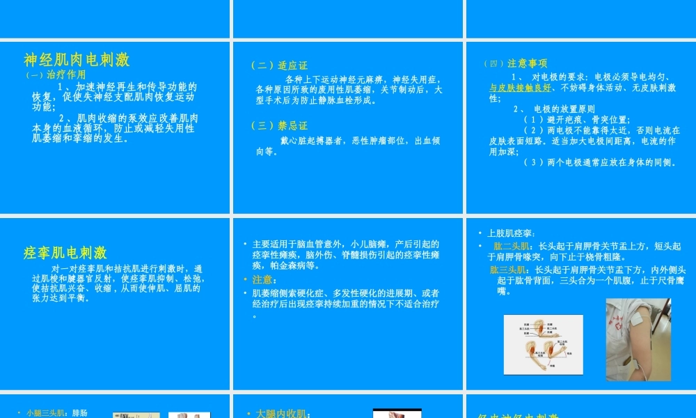 理疗概述.ppt