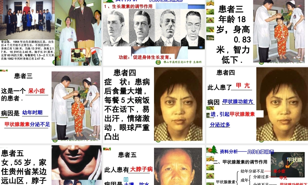 甲状腺激素分泌异常功能.ppt