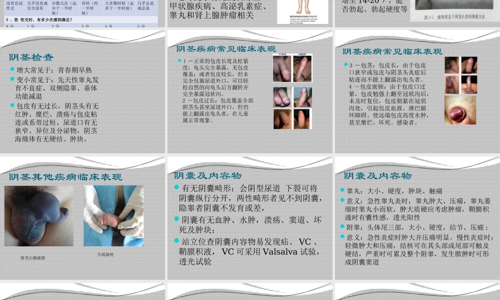 泌尿男性生殖系统常见症状及检查.ppt