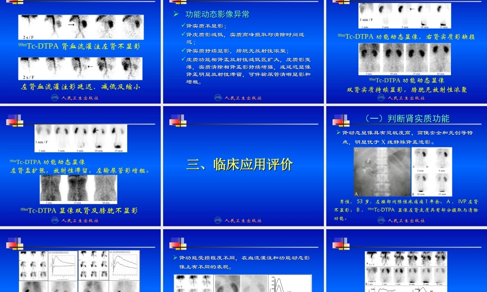 泌尿系统001分析资料.ppt