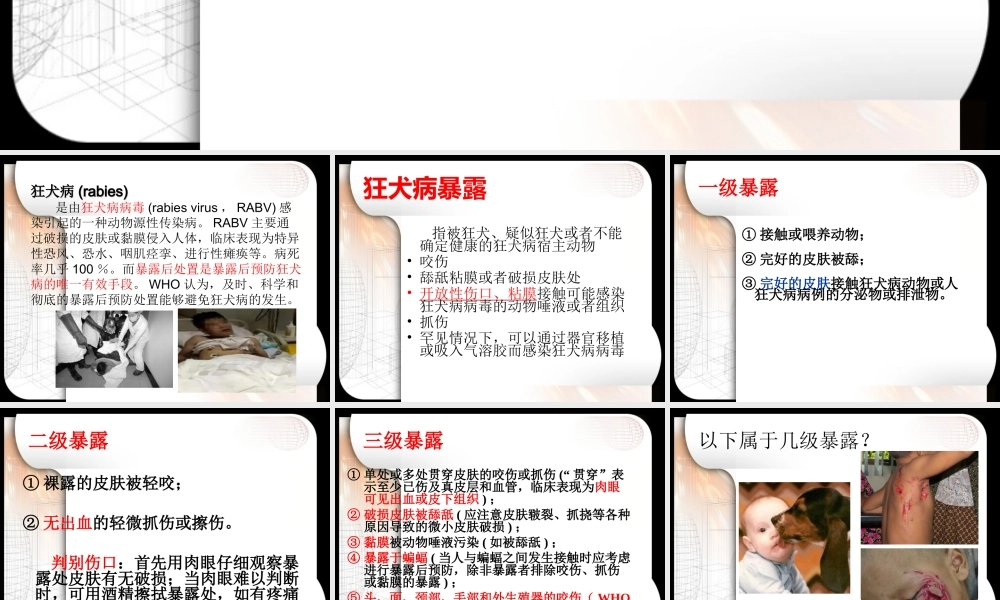 狂犬病暴露后急诊处置.ppt