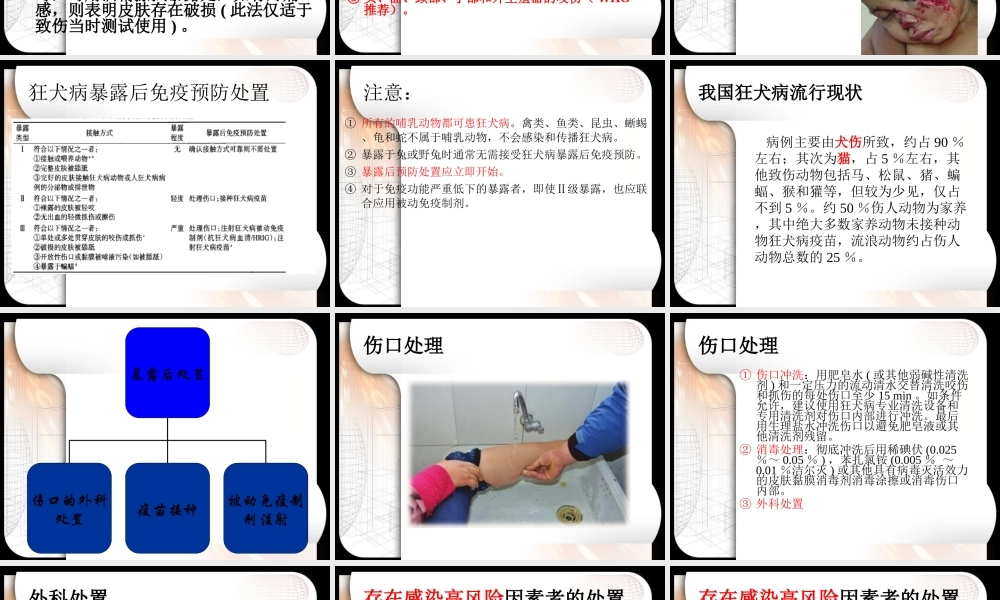 狂犬病暴露后急诊处置.ppt