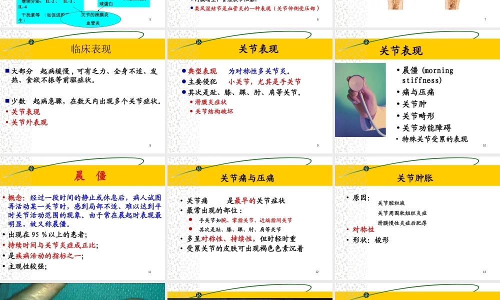 李秋平-类风湿关节炎1已改.ppt