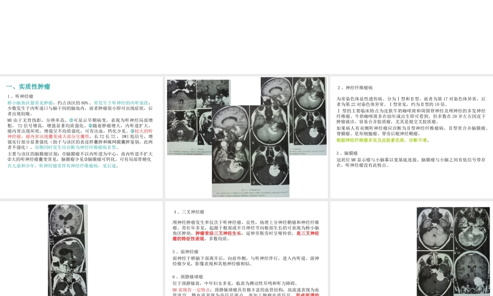 桥小脑角区占位病变.ppt