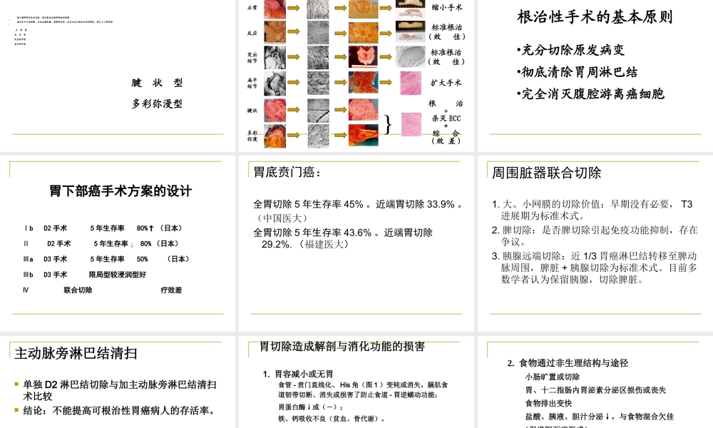 正确选择胃癌胃切除的重建术.ppt