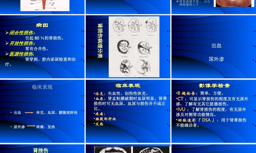 泌尿系损伤.ppt