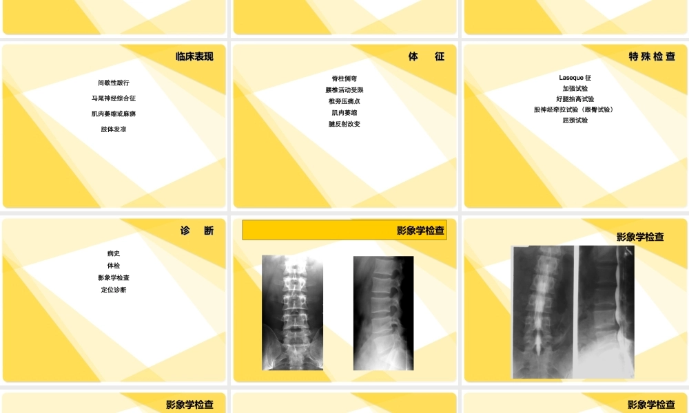 腰-间-盘-突-出-症.ppt