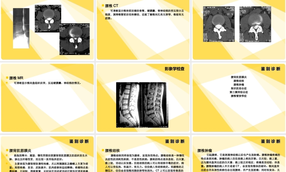 腰-间-盘-突-出-症.ppt
