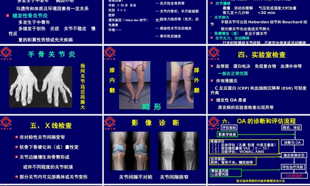 民勤县协和医院骨关节炎诊治指南.ppt