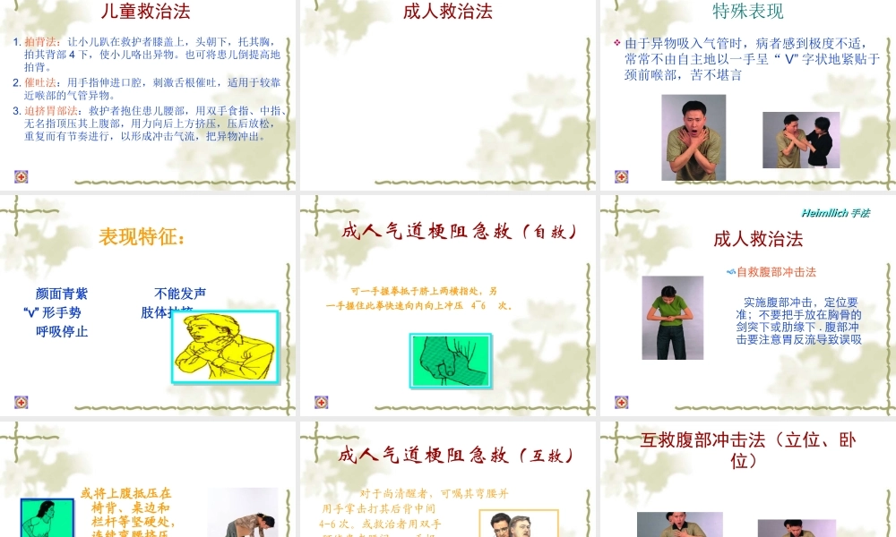 气管异物梗塞急救(27).ppt