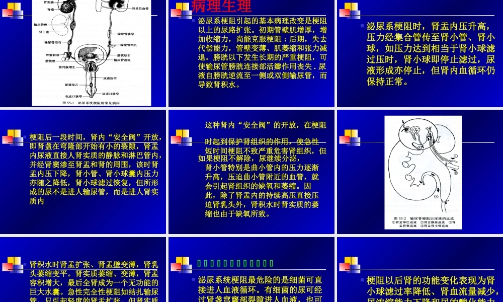 泌尿系统梗阻分析.ppt
