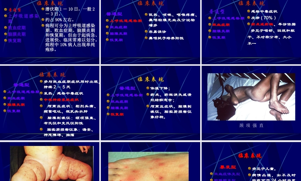 流行性脑脊髓膜炎夏.ppt