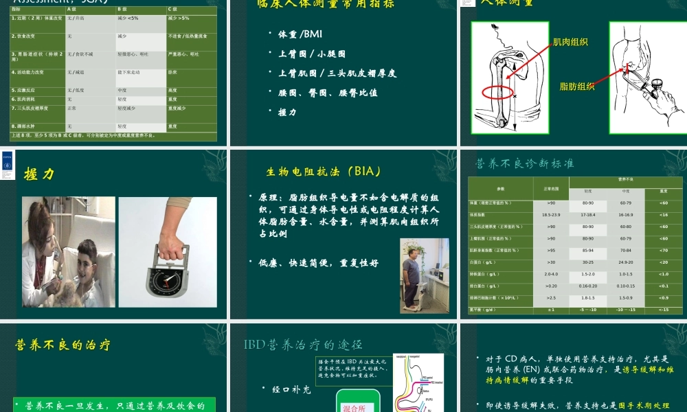 炎症性肠病患者与营养支持.ppt