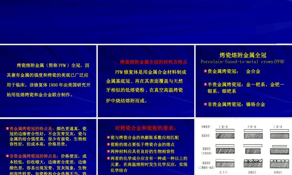 烤瓷熔附金属全冠修复成功的关键要素南京医科大学附属口腔医院.ppt