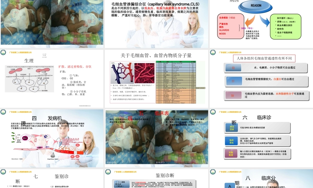 毛细血管渗漏综合征-王玉.pptx