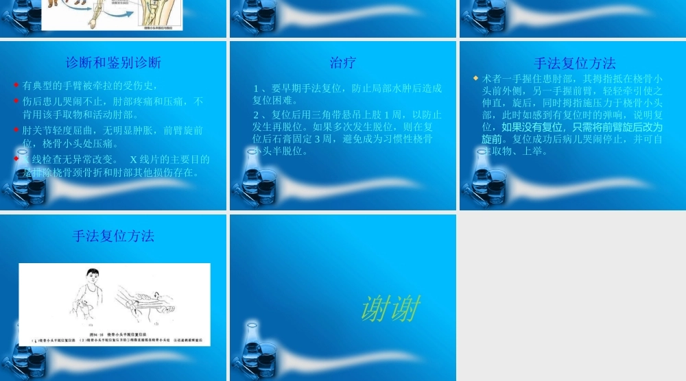 桡骨小头半脱位.ppt