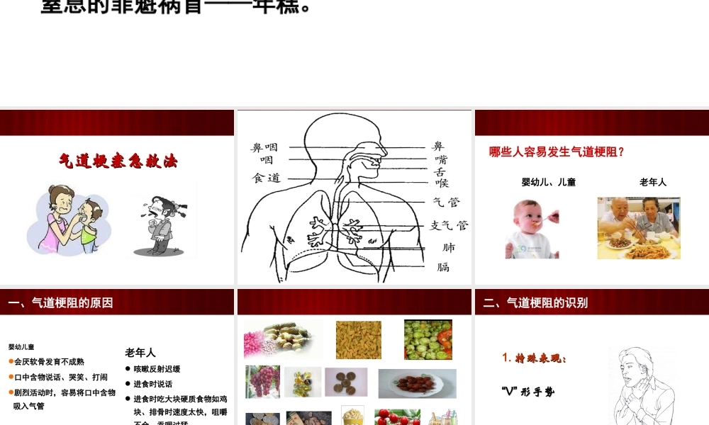 气道梗阻急救法.ppt