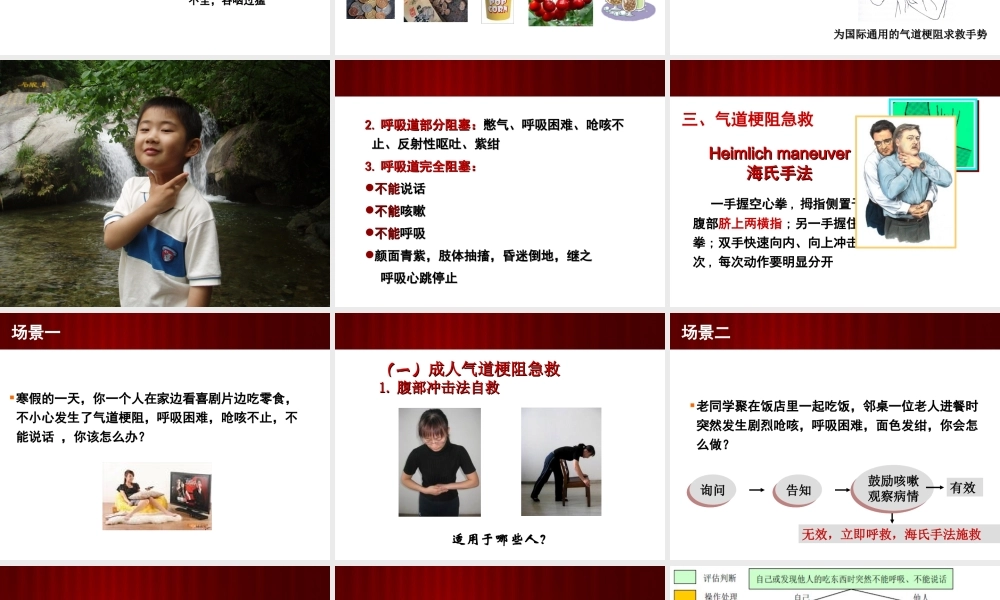 气道梗阻急救法.ppt