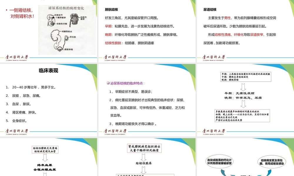 泌尿系结核.pptx