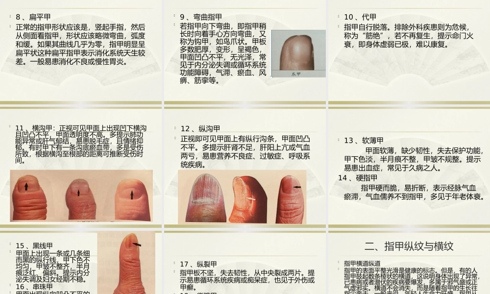 手诊第四节指甲知健康.pptx