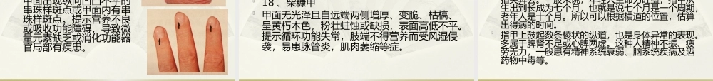 手诊第四节指甲知健康.pptx