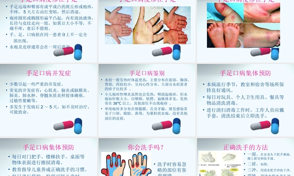 手足口病知识.ppt