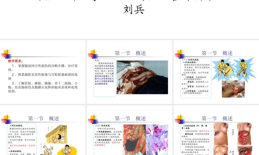 普外-腹部损伤.ppt