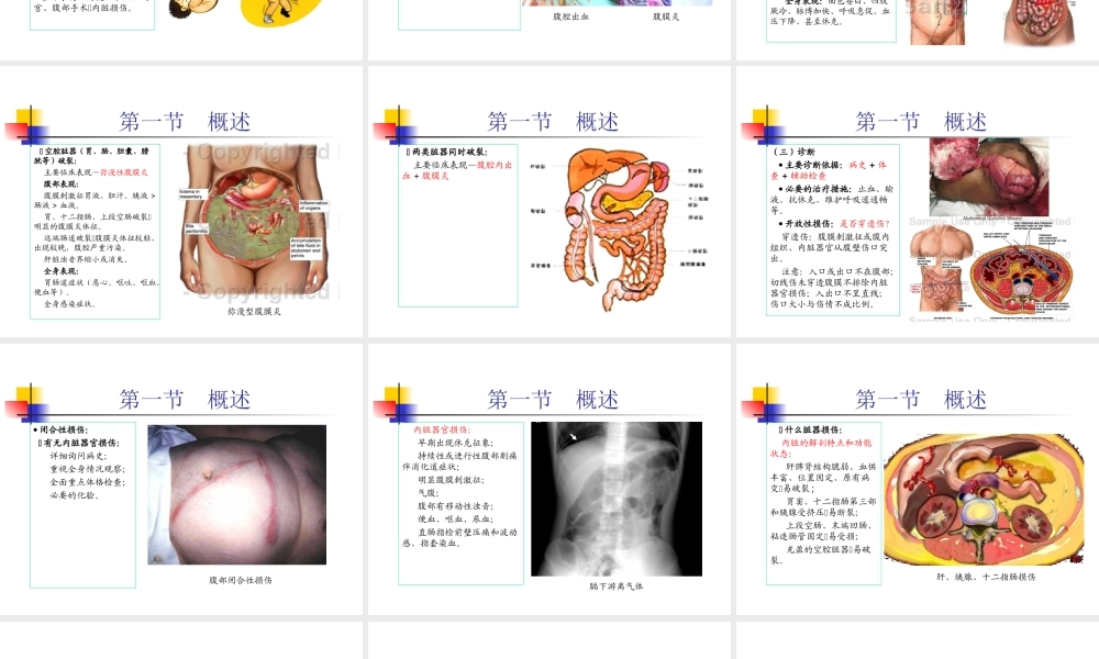 普外-腹部损伤.ppt