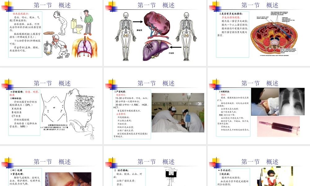普外-腹部损伤.ppt