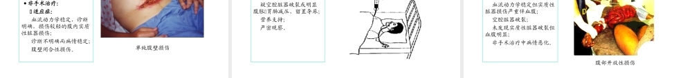 普外-腹部损伤.ppt
