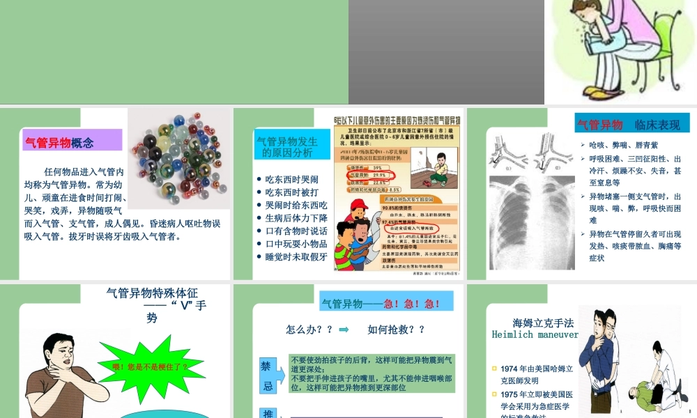 气管异物急救.ppt