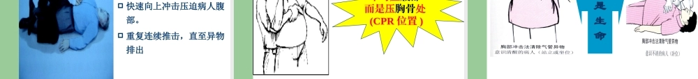 气管异物急救.ppt