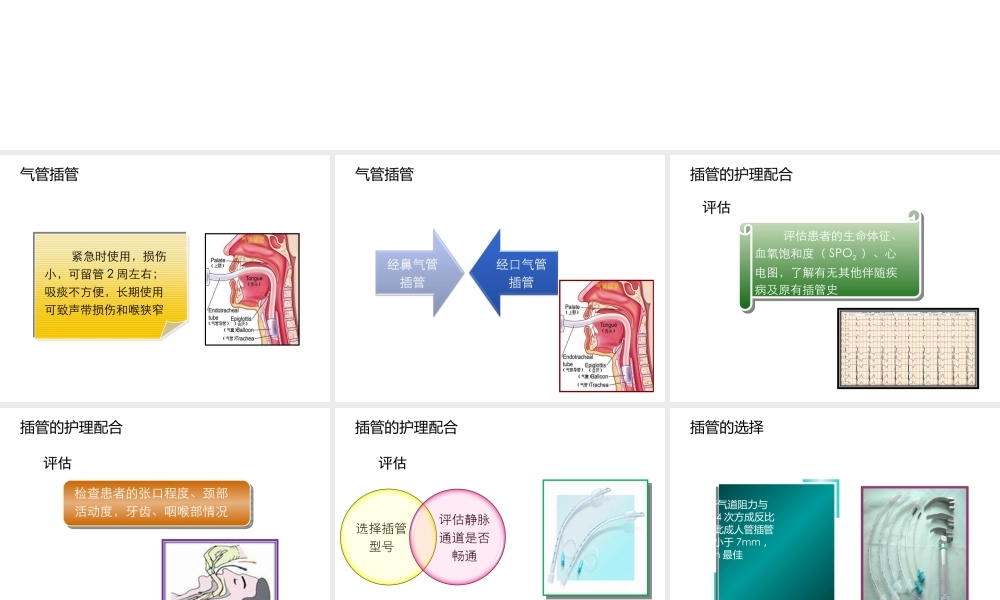 气管插管和气道湿化.ppt